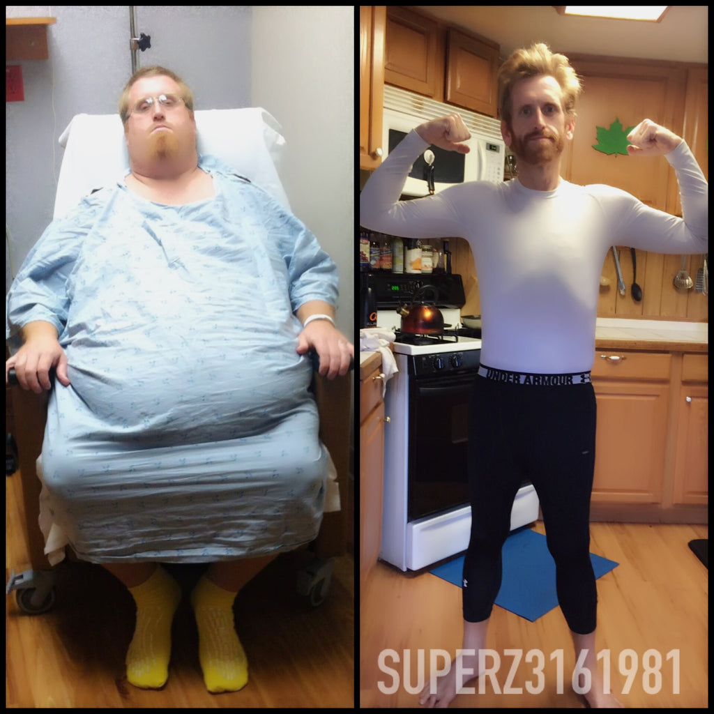 315 Pounds Lost: I beat obesity!
